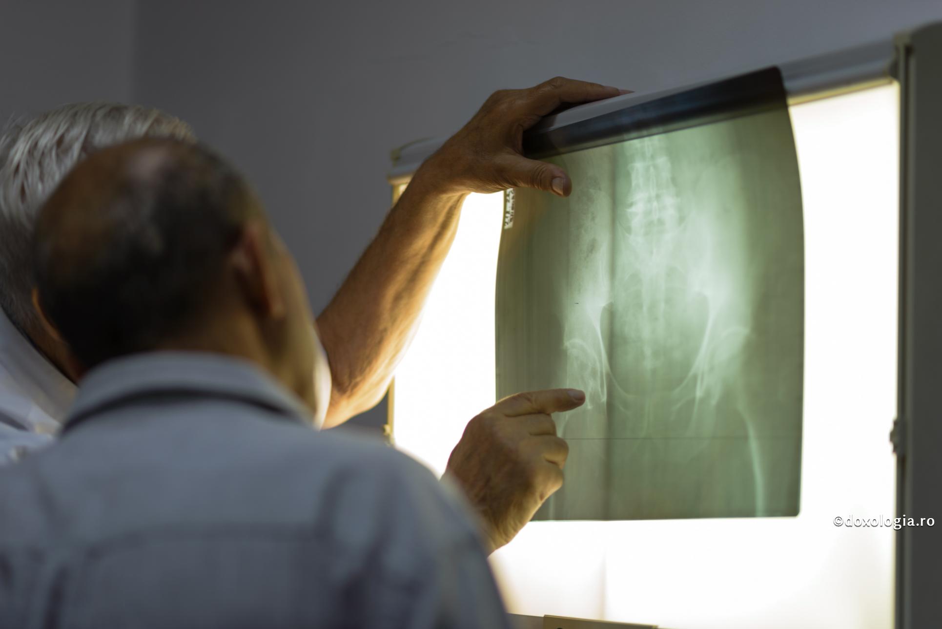 Rugăciunea și milostenia – tratamentul meu pentru carcinomul spinocelular / Foto: Oana Nechifor radiografie