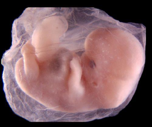 Pepsi neagă folosirea celulelor de fetuşi avortaţi în cercetare şi dezvoltare
