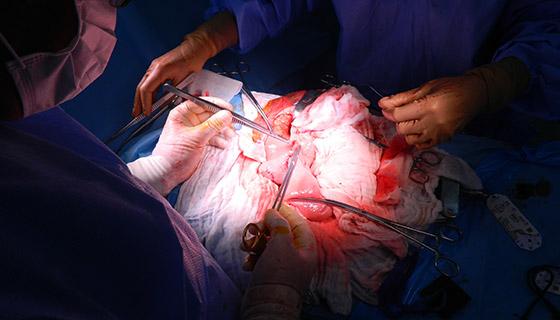 Pacient: Occidentul. Diagnostic: cancer cu metastaze Pacient: Occidentul. Diagnostic: cancer cu metastaze