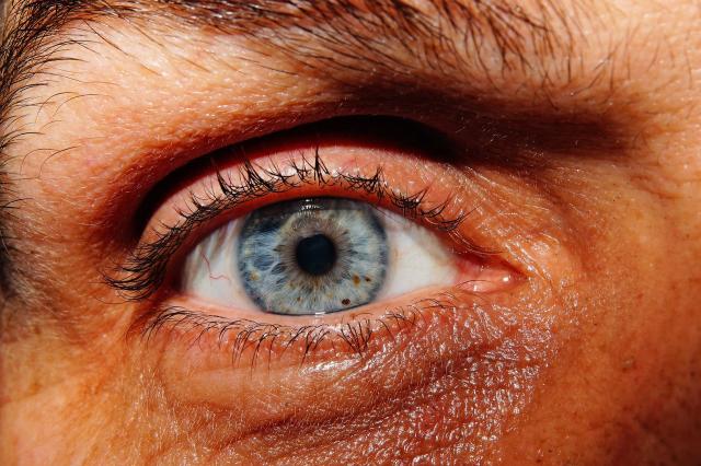 Remedii naturale pentru dermatita de contact a ochiului