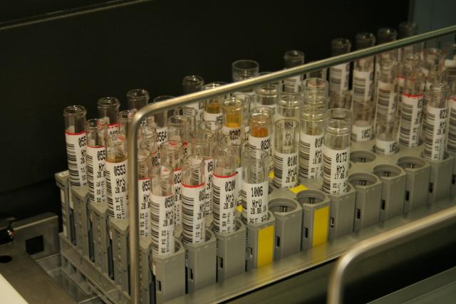 În viitor, analiza urinei ar putea înlocui analizele de sânge şi biopsiile