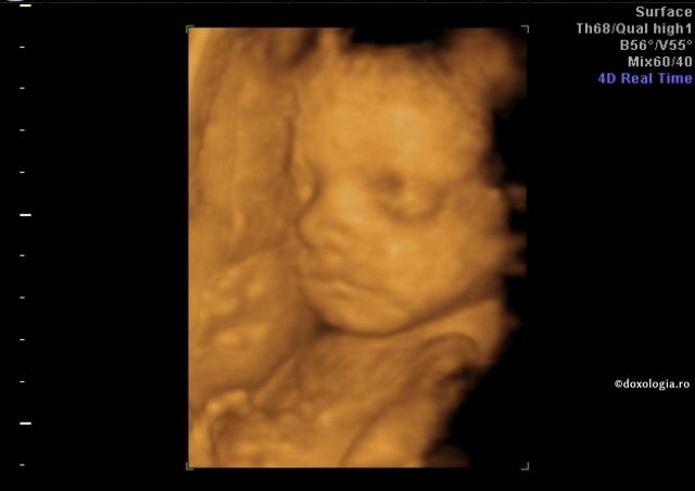 Și bărbatul este vinovat de avort Și bărbatul este vinovat de avort